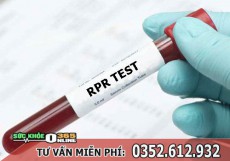 Xét nghiệm RPR là gì? Treponema pallidum RPR định tính và định lượng